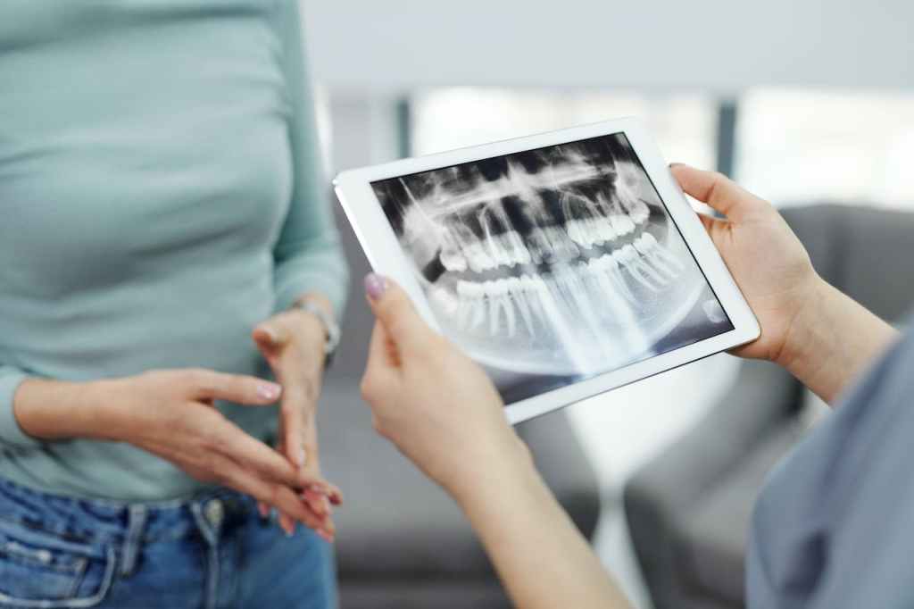 xray of mouth